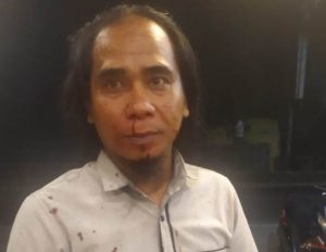 Ketua LSM Ommbak Sumut Dianiaya di Perbaungan