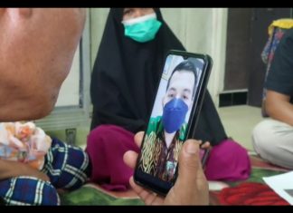 Ketua DPRD Sergai : Bayi Penderita Hidrosefalus Segera Dirujuk