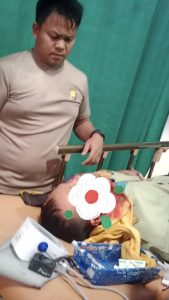 Sadis! Petani di Lebong Ditebas Parang Gara-Gara  Hal Sepele, Wajah Korban Luka Parah